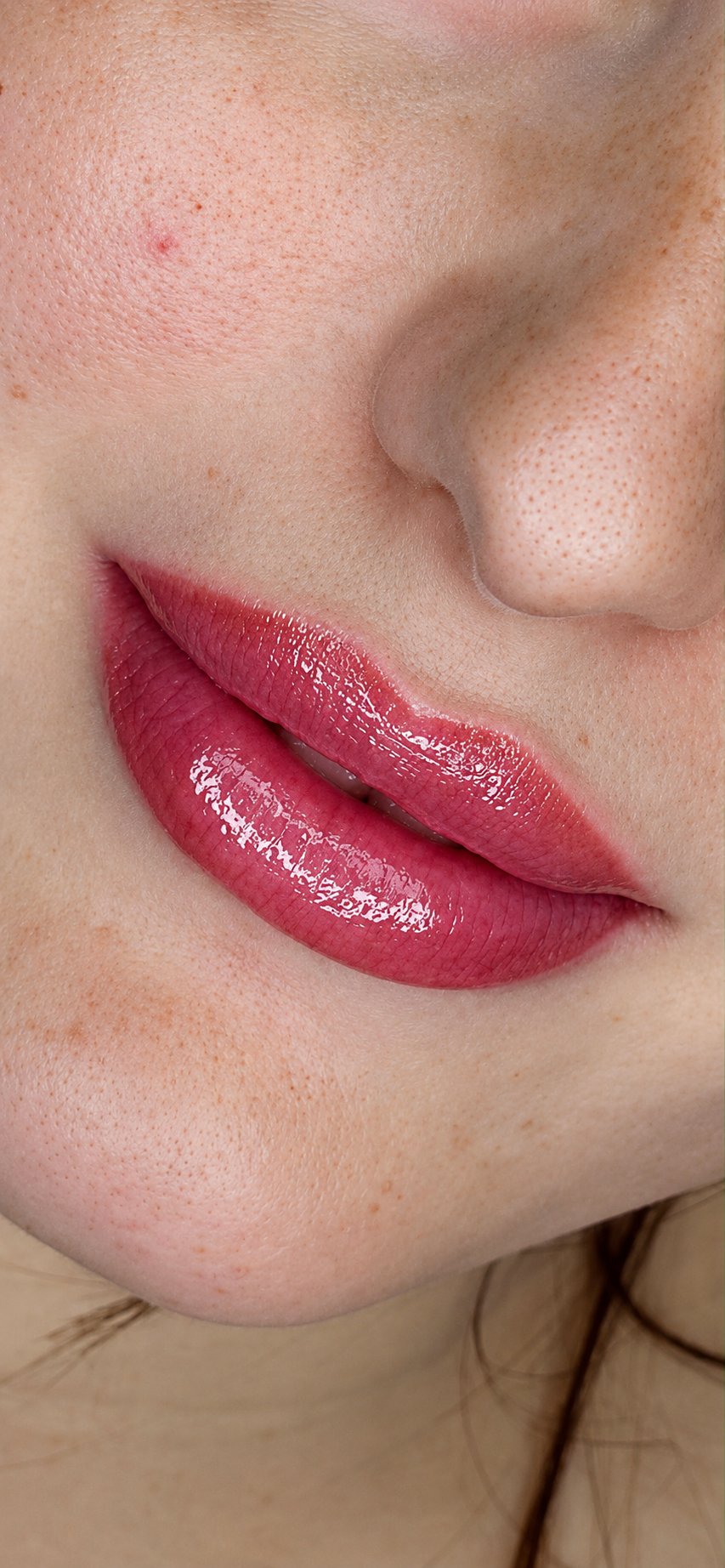 Full Lips — dopo